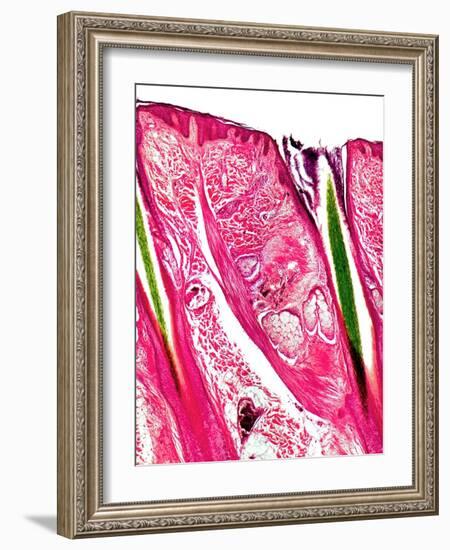 Skin Section, Light Micrograph-Dr. Keith Wheeler-Framed Photographic Print