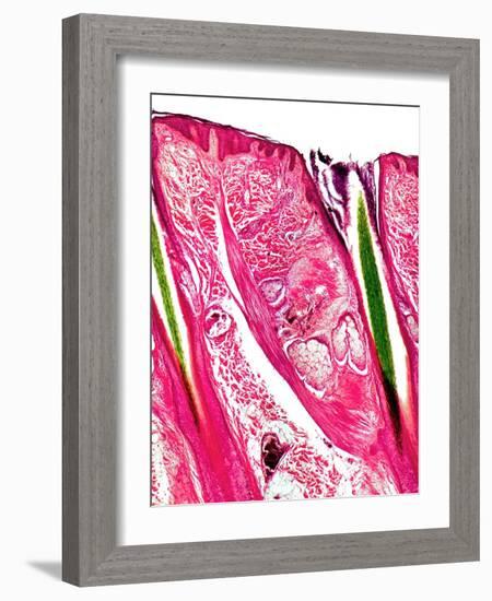 Skin Section, Light Micrograph-Dr. Keith Wheeler-Framed Photographic Print