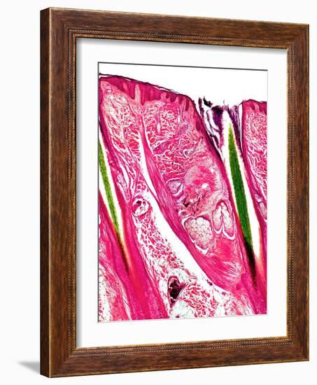 Skin Section, Light Micrograph-Dr. Keith Wheeler-Framed Photographic Print