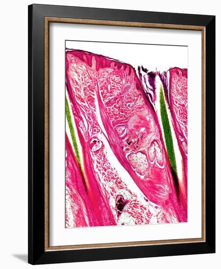 Skin Section, Light Micrograph-Dr. Keith Wheeler-Framed Photographic Print