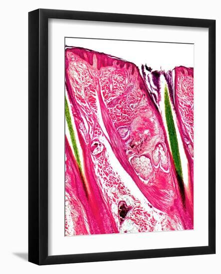 Skin Section, Light Micrograph-Dr. Keith Wheeler-Framed Photographic Print