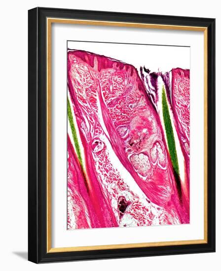 Skin Section, Light Micrograph-Dr. Keith Wheeler-Framed Photographic Print