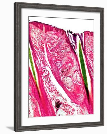 Skin Section, Light Micrograph-Dr. Keith Wheeler-Framed Photographic Print