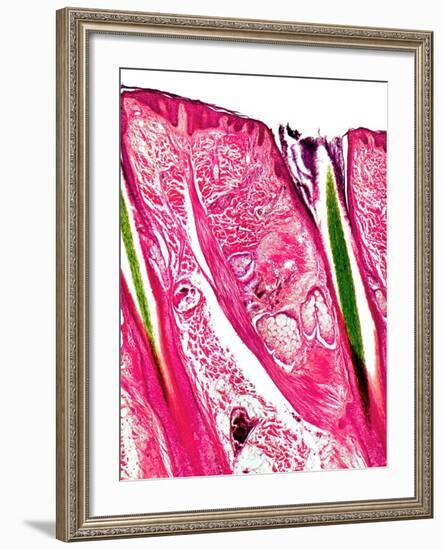 Skin Section, Light Micrograph-Dr. Keith Wheeler-Framed Photographic Print