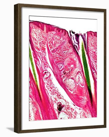 Skin Section, Light Micrograph-Dr. Keith Wheeler-Framed Photographic Print