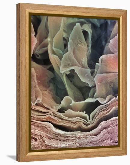 Skin Surface, SEM-Steve Gschmeissner-Framed Premier Image Canvas
