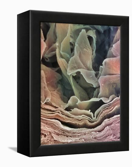 Skin Surface, SEM-Steve Gschmeissner-Framed Premier Image Canvas