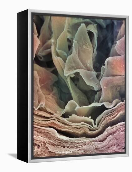 Skin Surface, SEM-Steve Gschmeissner-Framed Premier Image Canvas