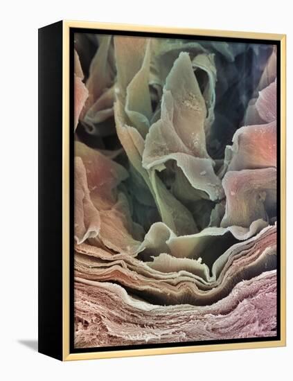 Skin Surface, SEM-Steve Gschmeissner-Framed Premier Image Canvas