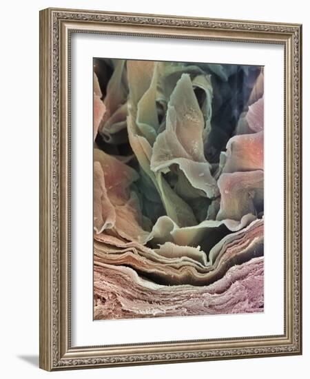Skin Surface, SEM-Steve Gschmeissner-Framed Photographic Print