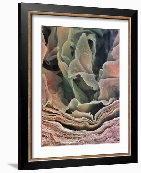 Skin Surface, SEM-Steve Gschmeissner-Framed Photographic Print