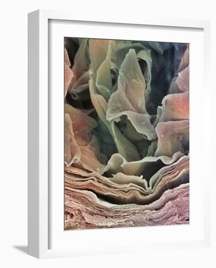 Skin Surface, SEM-Steve Gschmeissner-Framed Photographic Print