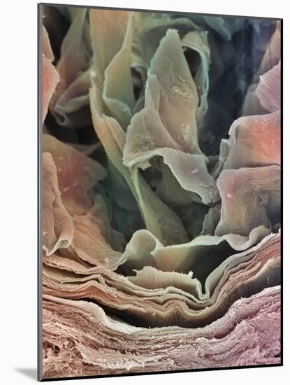 Skin Surface, SEM-Steve Gschmeissner-Mounted Photographic Print