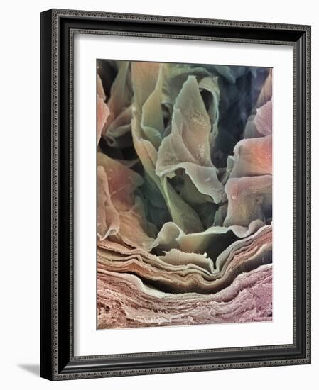 Skin Surface, SEM-Steve Gschmeissner-Framed Photographic Print