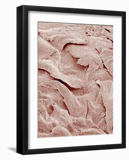 Skin Surface, SEM-Susumu Nishinaga-Framed Photographic Print