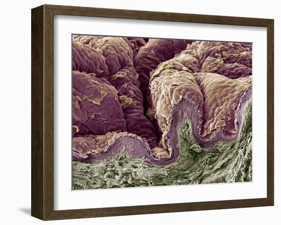 Skin Tissue, SEM-Steve Gschmeissner-Framed Photographic Print