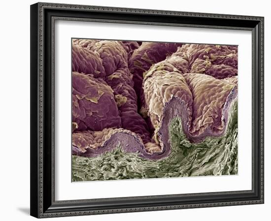 Skin Tissue, SEM-Steve Gschmeissner-Framed Photographic Print