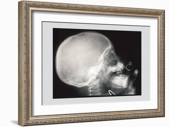 Skull and Hand-null-Framed Art Print