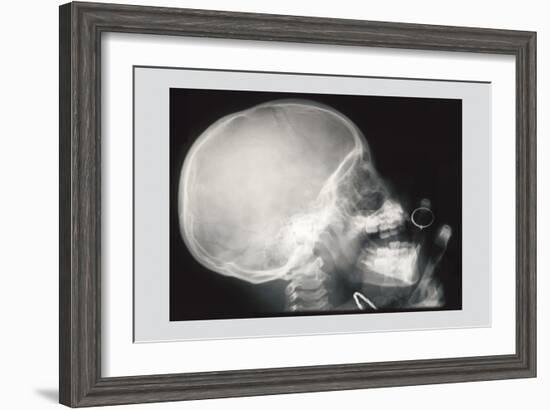 Skull and Hand-null-Framed Art Print