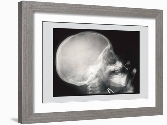 Skull and Hand-null-Framed Art Print