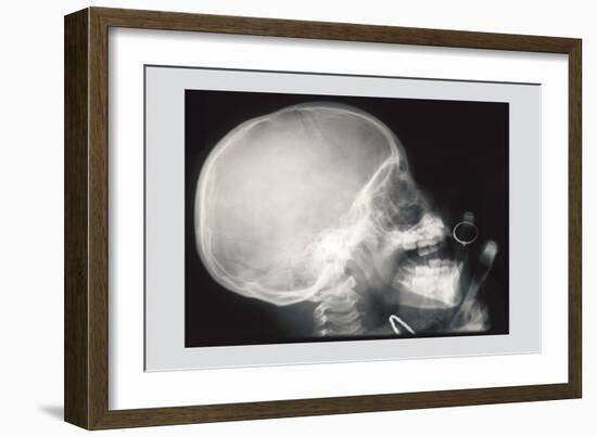 Skull and Hand-null-Framed Art Print