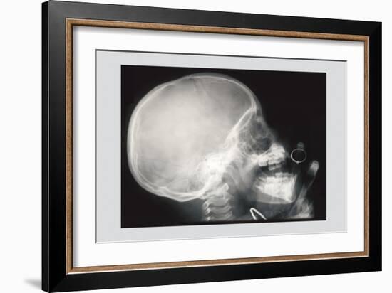 Skull and Hand-null-Framed Art Print