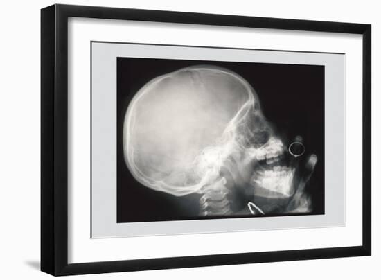 Skull and Hand-null-Framed Art Print