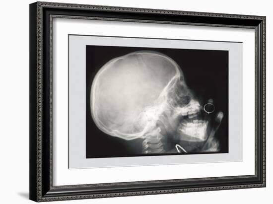 Skull and Hand-null-Framed Art Print