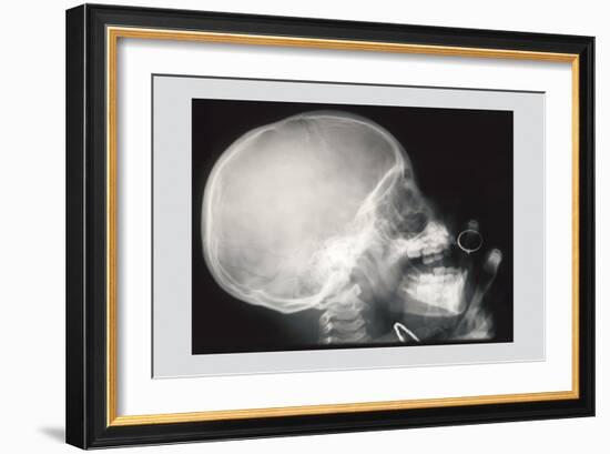 Skull and Hand-null-Framed Art Print