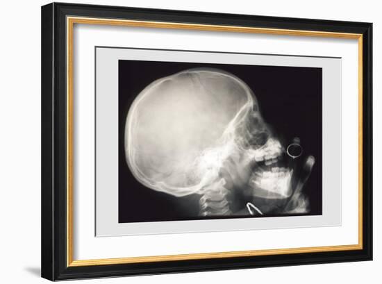 Skull and Hand-null-Framed Premium Giclee Print