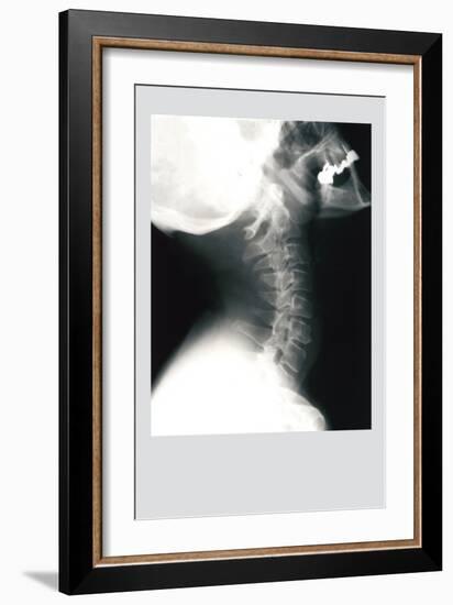 Skull and Neck-null-Framed Art Print