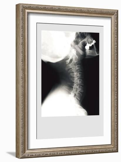 Skull and Neck-null-Framed Premium Giclee Print