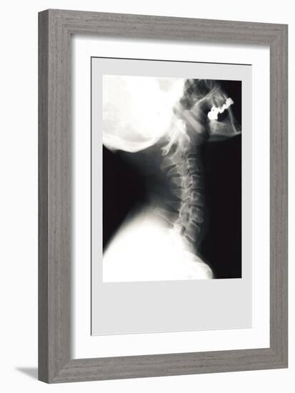 Skull and Neck-null-Framed Premium Giclee Print