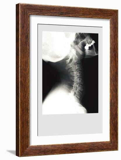 Skull and Neck-null-Framed Premium Giclee Print