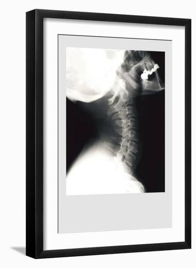 Skull and Neck-null-Framed Premium Giclee Print