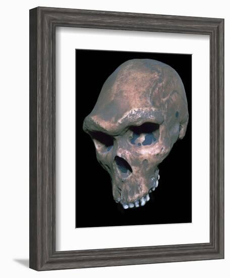 Skull of Homo Sapiens. Artist: Unknown-Unknown-Framed Giclee Print