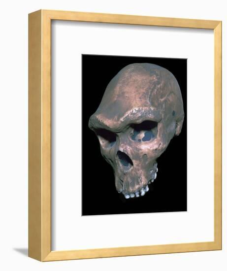 Skull of Homo Sapiens. Artist: Unknown-Unknown-Framed Giclee Print