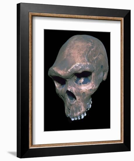 Skull of Homo Sapiens. Artist: Unknown-Unknown-Framed Giclee Print