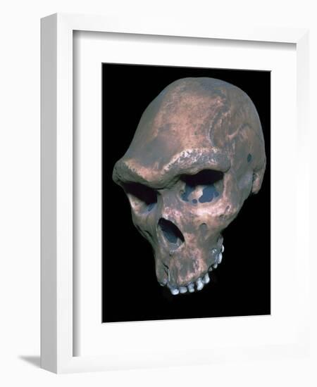 Skull of Homo Sapiens. Artist: Unknown-Unknown-Framed Giclee Print