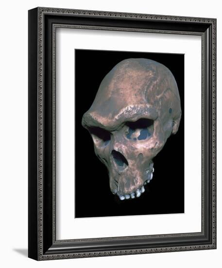 Skull of Homo Sapiens. Artist: Unknown-Unknown-Framed Giclee Print