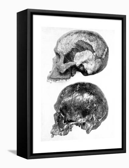 Skull of Piltdown Man (Eanothropus Daswon), 1912-null-Framed Premier Image Canvas
