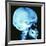 Skull X-ray-PASIEKA-Framed Photographic Print