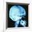 Skull X-ray-PASIEKA-Framed Photographic Print