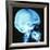 Skull X-ray-PASIEKA-Framed Photographic Print