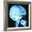 Skull X-ray-PASIEKA-Framed Photographic Print