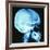 Skull X-ray-PASIEKA-Framed Photographic Print