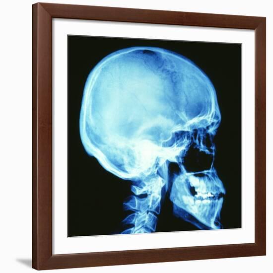 Skull X-ray-PASIEKA-Framed Photographic Print