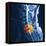 Slipped Disc, MRI Scan-PASIEKA-Framed Premier Image Canvas