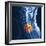 Slipped Disc, MRI Scan-PASIEKA-Framed Premium Photographic Print