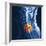 Slipped Disc, MRI Scan-PASIEKA-Framed Premium Photographic Print